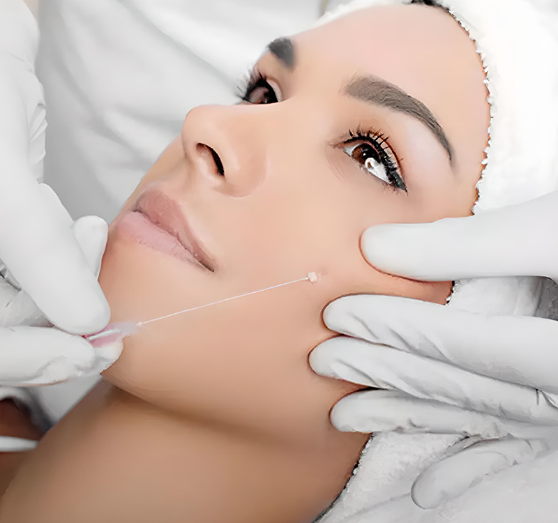 Lifting Facial Non Chirurgical