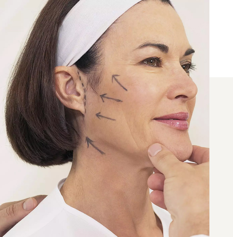 Lifting Facial Non Chirurgical